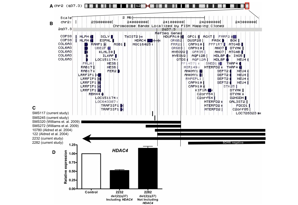 ## Context ID: pqac-00000019 Figure 1 shows the delineation of the BDMR (Brachydactyly Mental Retardation Syndrome) critical region through deletion mapping of 