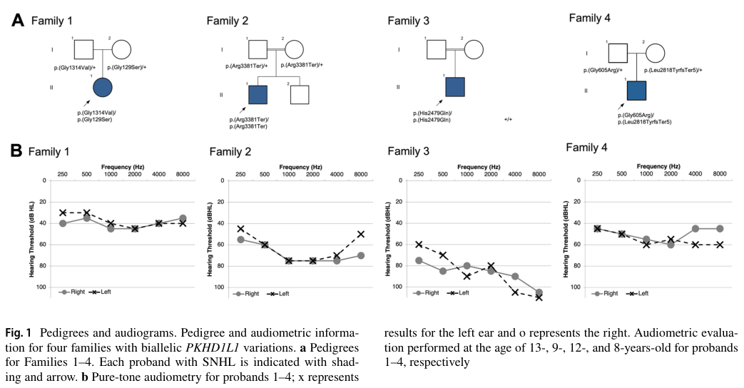 ## Context ID: pqac-00000038 Figure 1 from the document, displaying the pedigrees (A) and audiograms (B) for Families 1-4, is provided. The audiometric patterns