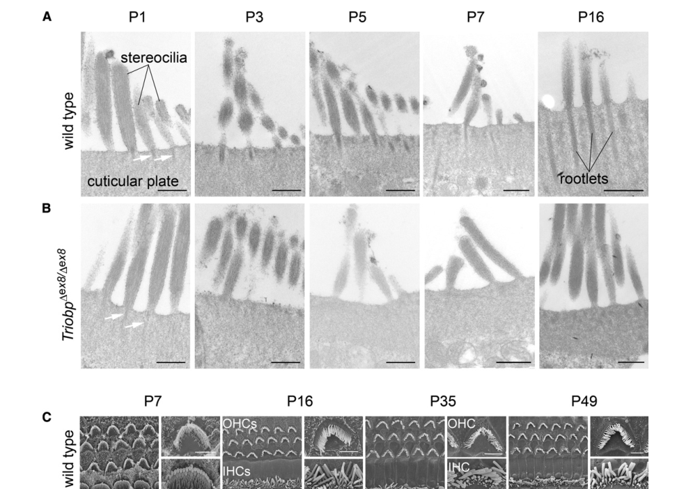 ## Context ID: pqac-00000066 I have extracted the requested figure panels: - Figure 6 Panels A and B: TEM images of WT and Triobp mutant stereocilia rootlets, s