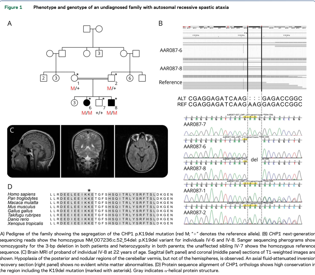 ## Context ID: pqac-00000008 The requested information, including the pedigree, variant details (CHP1 c.52_54del / p.Lys19del), and brain MRI showing cerebellar