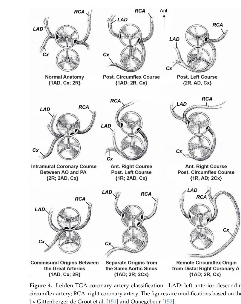 ## Context ID: pqac-00000082 The document contains several figures and a table that summarize the arterial switch operation (ASO) and coronary transfer patterns