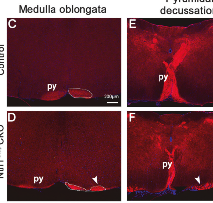 ## Context ID: pqac-00000016 The corticospinal tract (CST) midline crossing defects and symmetric (mirror) movement quantification in $Ntn1^{Gfap}$ CKO mice are