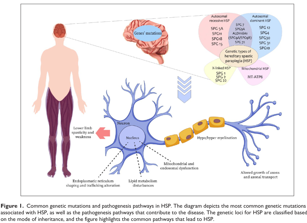 ## Context ID: pqac-00000034 Figure 1 provides a summary of hereditary spastic paraplegia (HSP) classification, key genes, and pathogenic mechanisms. It classif