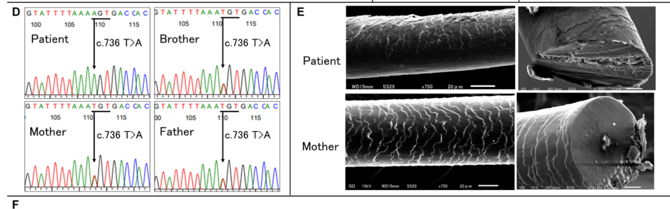 ## Context ID: pqac-00000008 The provided images show the requested information: - Figure 1D (left side of the first image) summarizes the genetic analysis of t