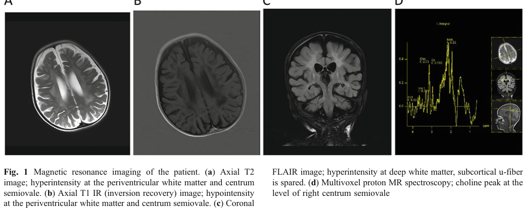 ## Context ID: pqac-00000015 The document includes several figures and tables summarizing the patient's clinical and diagnostic findings: - **MRI Findings**: Fi