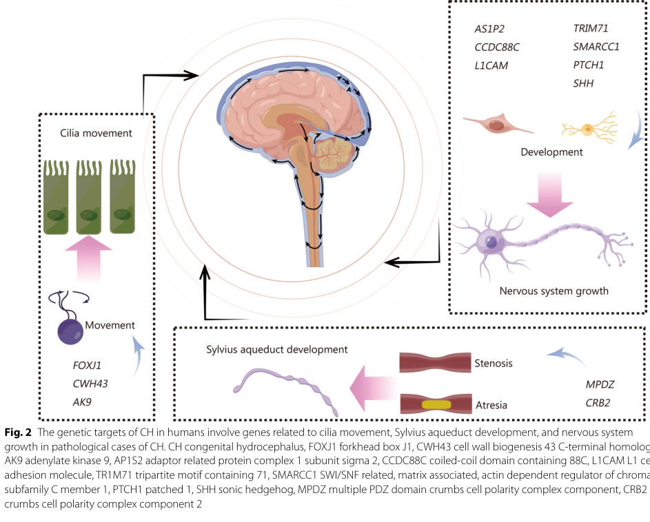 ## Context ID: pqac-00000017 Figure 2 provides a comprehensive summary of the genetic causes and key pathways of congenital hydrocephalus (CH) in humans. It cat