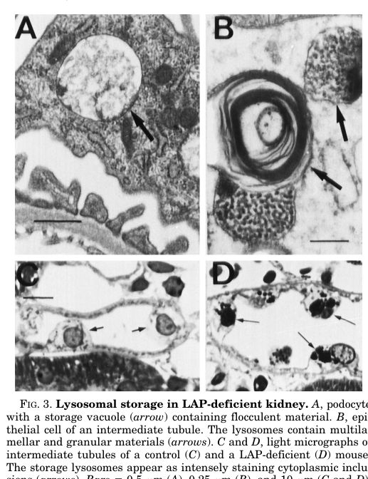 ## Context ID: pqac-00000004 The provided scientific document details the phenotypes of lysosomal acid phosphatase (LAP)-deficient mice. The following figures s