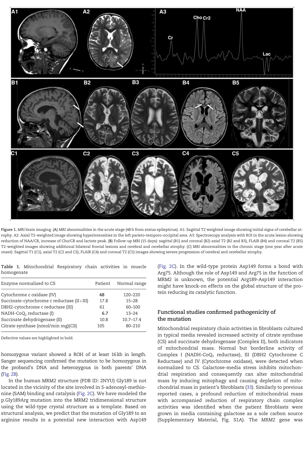 ## Context ID: pqac-00000038 The requested panels (A, B, and C) of Figure 1, illustrating serial brain MR images, are provided. These images show the initial le