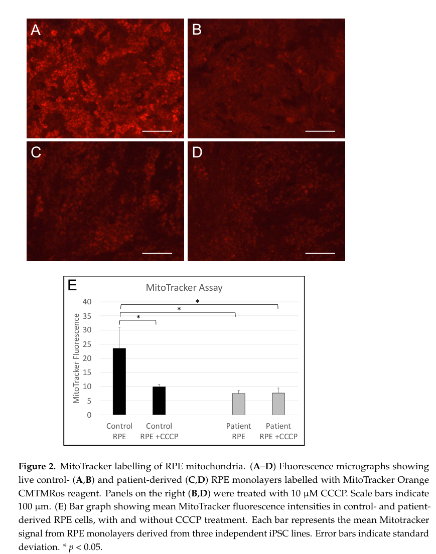 ## Context ID: pqac-00000013 The document does not contain a figure or table summarizing the clinical features or imaging findings of RCBTB1-associated retinopa