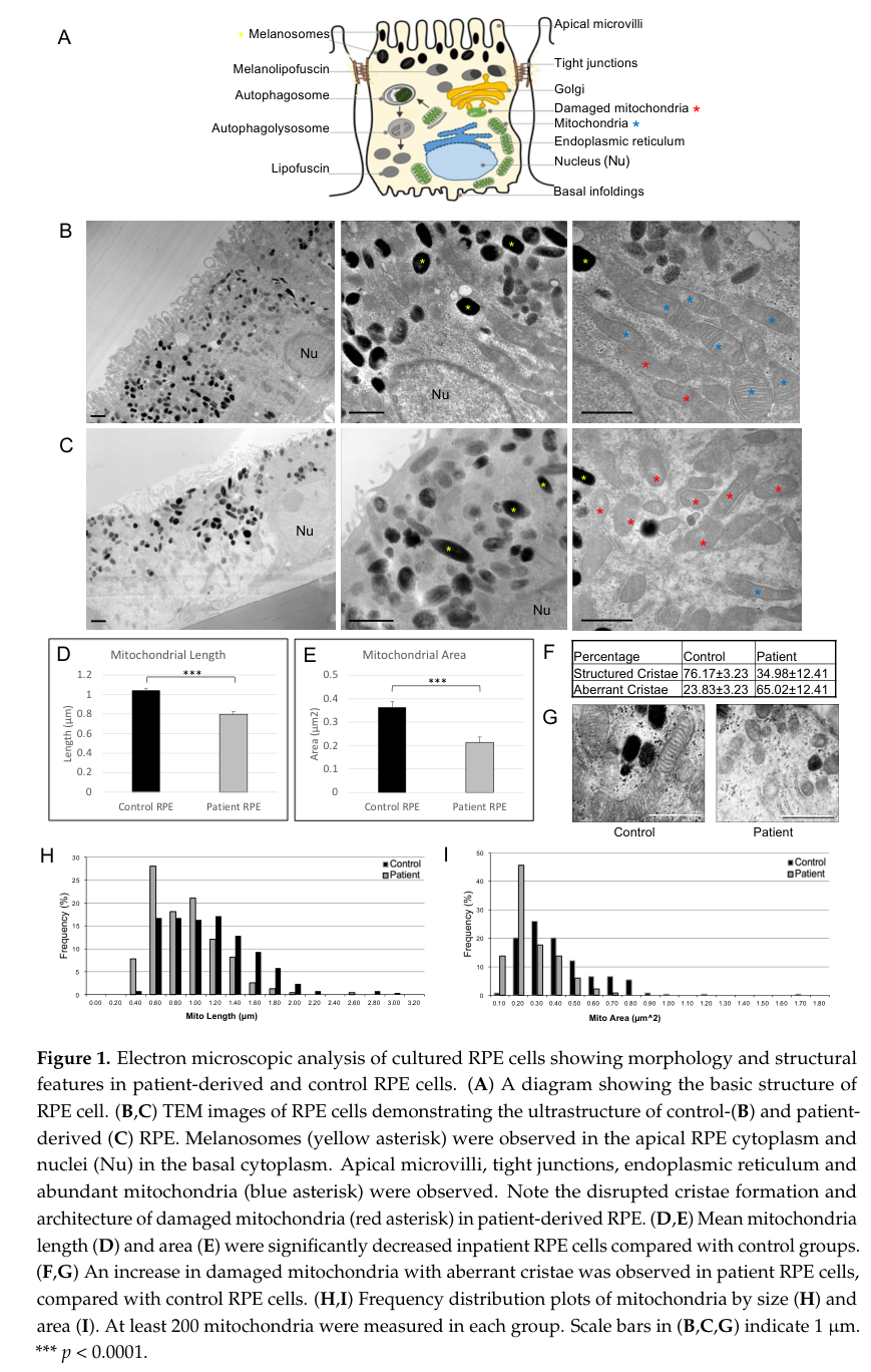 ## Context ID: pqac-00000015 I have extracted Figure 1 (TEM mitochondrial abnormalities) and Figure 2 (MitoTracker assay) along with their respective legends. F