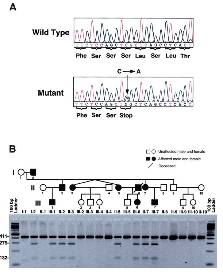 ## Context ID: pqac-00000016 The pedigree figure and the table summarizing clinical features for the family with the MSX1 S202X mutation (causing Witkop syndrom