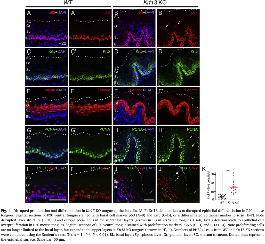## Context ID: pqac-00000038 Figure 4 shows that Krt13 deletion leads to increased epithelial cell proliferation. Specifically, panels G-H show PCNA staining an